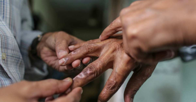 দেশে কুষ্ঠ রোগী বেশি মৌলভীবাজারে, মৃ ত্যু ২ দেশে কুষ্ঠ রোগী বেশি মৌলভীবাজারে, মৃ ত্যু ২