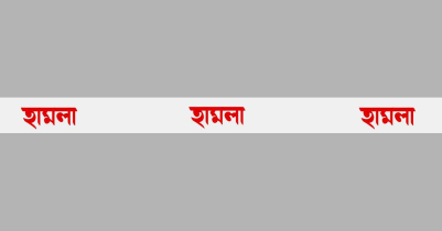 সিলেটে মধ্যরাতে আওয়ামী লীগ নেতার বাসায় হা ম লা 