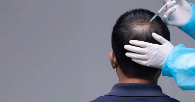 Which is the best country for `Hair Transplant`?