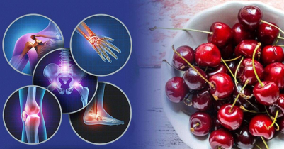 5 Foods that help ease your arthritis pain