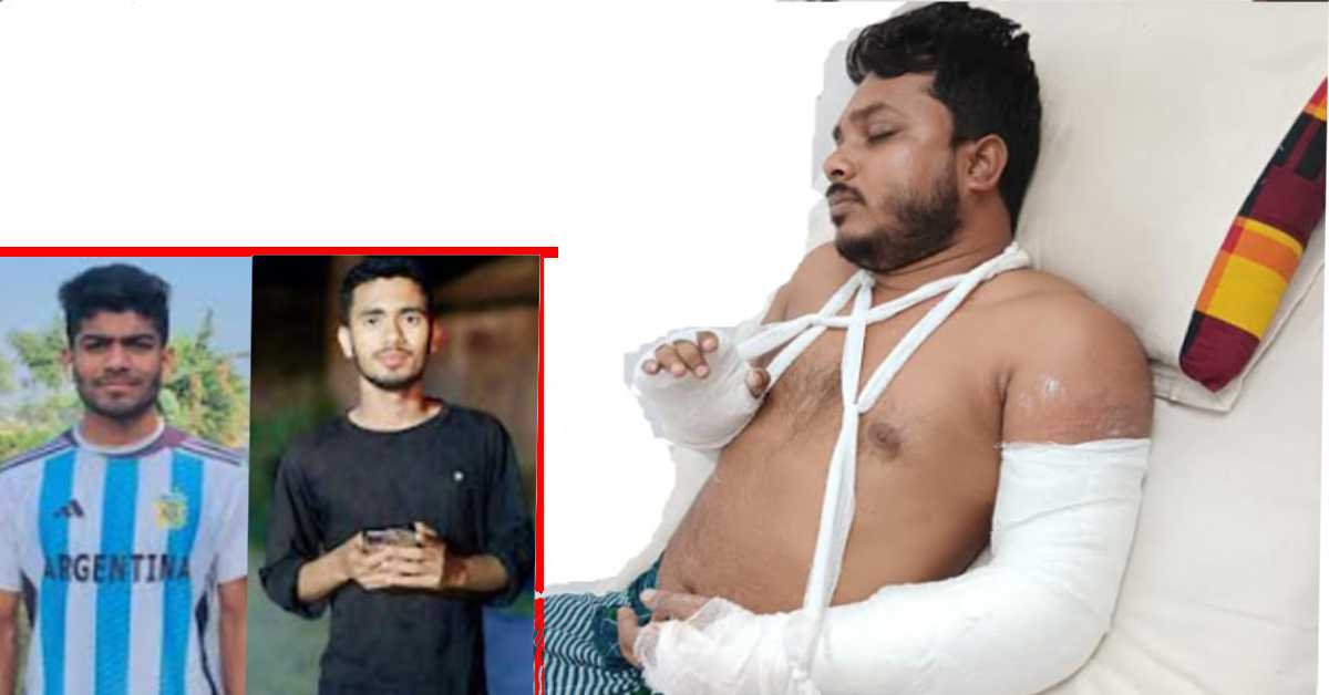কিশোর গ্যাং এর হা ম লা র শিকার শিক্ষক। ছবি- সংগৃহীত কিশোর গ্যাং এর হা ম লা র শিকার শিক্ষক। ছবি- সংগৃহীত