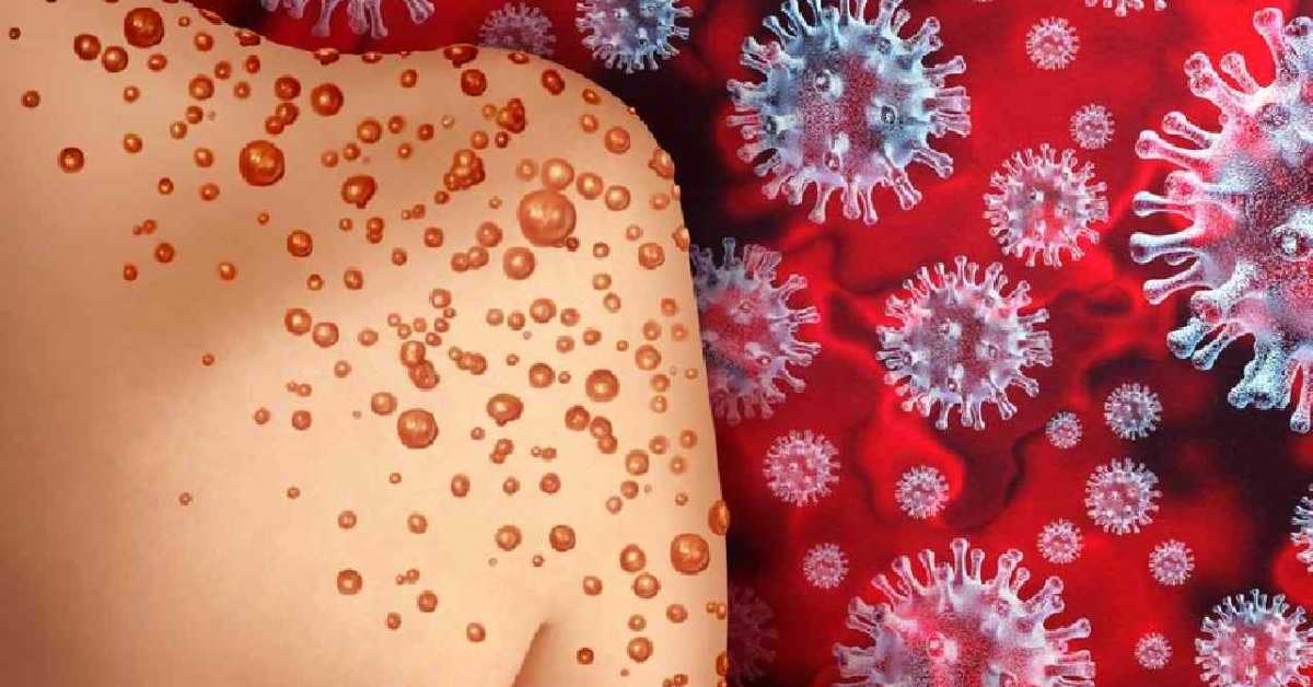 প্রতীকী ছবি