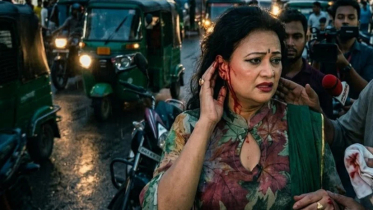 নায়িকার কান ছিঁড়ে স্বর্ণের দুল নিয়ে পালিয়ে যায় ছিনতাইকারী
