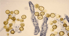 UK Health Authorities Monitor Rare Hantavirus Cases